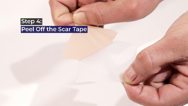 Amazon.com : GauzeCare Silicone Scar Tape – 1.6”x120” Roll