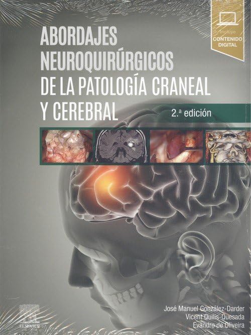 Abordajes neuroquirúrgicos de la patología craneal y cerebral