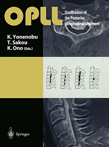 OPLL: Ossification of the Posterior Longitudinal