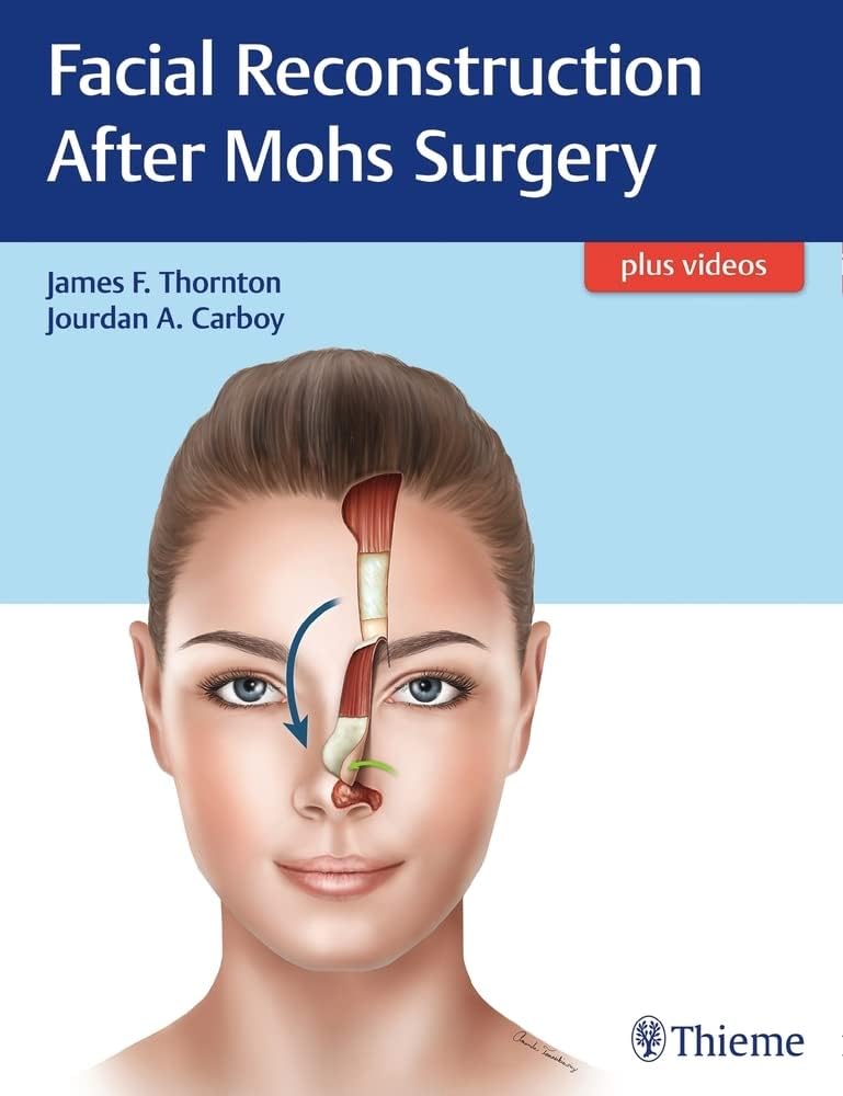 Facial Reconstruction After Mohs Surgery 1st Edition