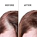 Bald Spot Hair Growth Cream | Scalp Treatment for Receding Hair | For Men and Women | Just Nutritive | 4 Oz