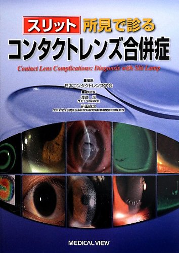 無料電子書籍 アプリ スリット所見で診る コンタクトレンズ合併症 バイ