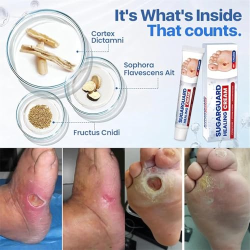 Cvreoz Sugar Guard Healing Cream, Healthy Feet Cream, Moisturizing & Soothing, Gentle Foot Care - Keep Feet Healthy (3Pcs, 1)