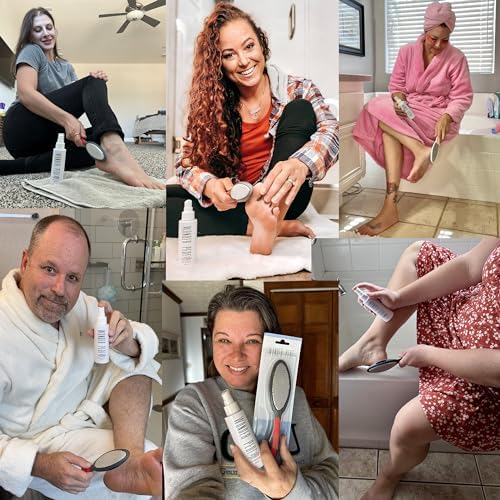 Image of Callus Remover - Three Minutes Fix- Foot File Rasp - Instant Foot Exfoliating Softener Peel Spray, Heels Callus Scrubber File - Home Spa Pedicure Treatment. Wonder Pedi