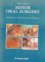 Atlas of Minor Oral Surgery 0723420386 Book Cover