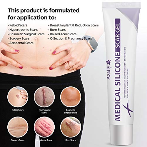 AZALLY-Advanced-Scar-Gel-Scar-Diminishing-Serum-Reduces-the-Appearance-of-Old-New-Scars-Best-Scar-Treatment-for-Repair-Scars-from-Burns-Cuts-Acne-Spots-Stretch-Marks-1oz