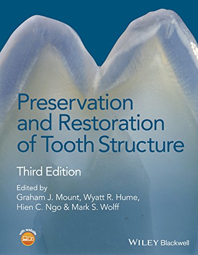 Preservation and Restoration of Tooth Structure Preservation and Restoration of Tooth Structure