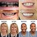 Carillas dentales Dientes Inferior de Sonrisa Instantánea Dentadura Inferiores para sonrisa perfecta,...