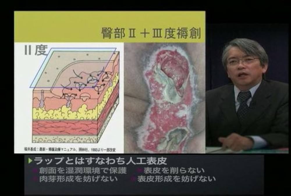 Amazon.co.jp: 褥創治療最前線! Dr.鳥谷部の超ラップ療法/ケアネット