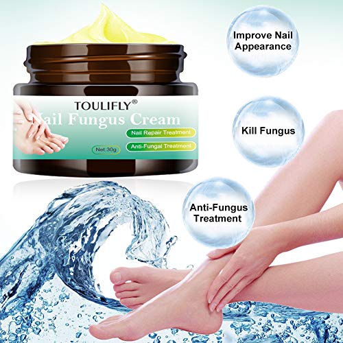 Nail Fungus Cream,Toenail Fungus Treatment,Nail Fungus Remover,Toenail Fingernail Fungus Remover Fungus Stop Cream