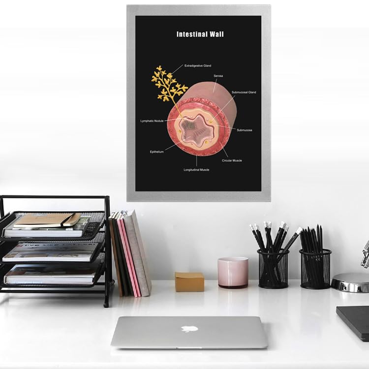 Image of Taanfu Body Educational Learning Anatomy Posters ，Intestine Wall Art Intestinal Villi Anatomy Art Poster Digestive System Organs Illustration Small Intestine Physiology Anatomy Wall Art Villi