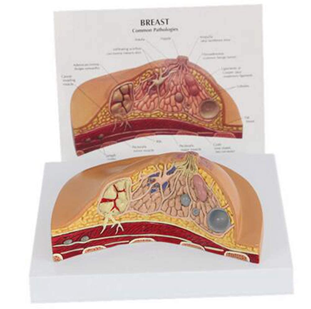 Buy XYXZ Anatomy Model Female Anatomy Model Lesion CrossSection With