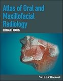 Atlas of Oral and Maxillofacial Radiology