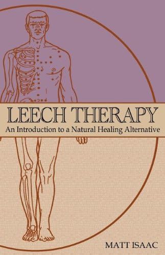 Leech Therapy: An Introduction to a Natural Healing Alternative