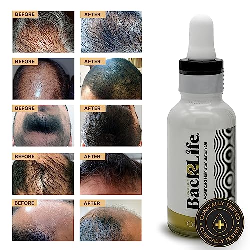 Back2Life 100% Natural Hair Stimulation & Beard Growth Oil-Get Rid of Patchy Beards & Hair-Beard serum to Moisturise, Hydrate & Condition-Repair & Rebalance Your Scalp & Regrow your Head & Beard Hair - Image 6