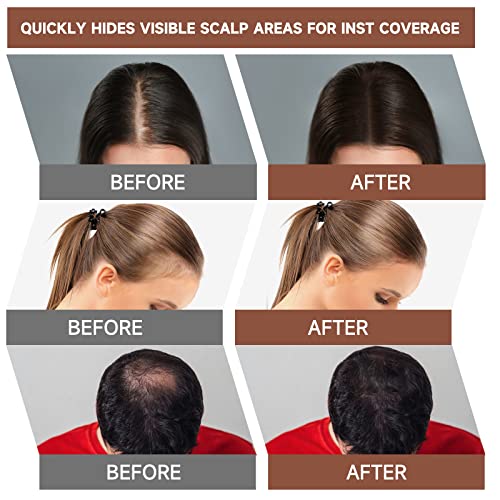 Mifeloy Root Touch Up Powder, Cover Up Hair Color For Grays, Root Coverage For Women Men, Roots Concealer For Beard Line Eyebrow, Instantly Shadow Powder For Thinning Grey Hairline, Medium Brown #TOP3