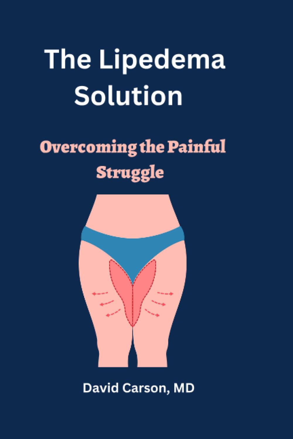 The Lipedema Solution: Overcoming the Painful Struggle
