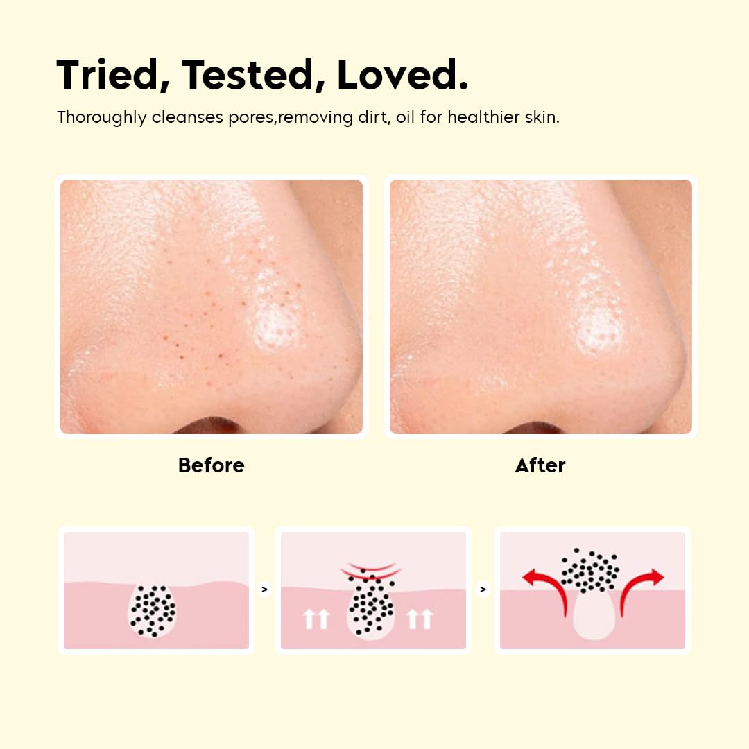Gleva Silicone Skincare Lip/Nose Exfoliator Deep Cleaning Blackhead Remover Facial Cleansing & Face Scrubber Brush, Smoother And Fuller Lip Appearance Pack Of 1 (Assorted) 4