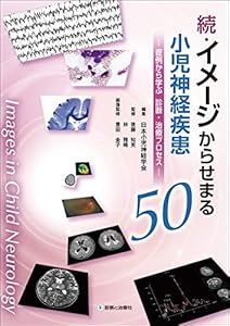 本の続・イメージからせまる小児神経疾患50―症例から学ぶ 診断・治療プロセス―の表紙