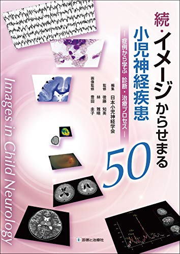 楽天 無料電子書籍 続・イメージからせまる小児神経疾患50―症例から学ぶ 診断・治療プロセ バイ