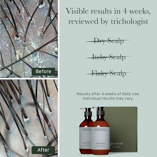 Good&All Tea Tree Shampoo and Conditioner Set for Dry Itchy Scalp with Peppermint - Sodium Lauryl Sulfate/Sulphate, Silicone, Paraben, Fragrance Free - 400ml - Image 3