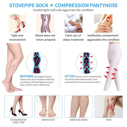 Image of Medical Compression Pantyhose for Women Support Stockings 20-30 mmHg Treatment Swelling, Edema Varicose Veins
