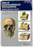 健康・医学 Atlas of Microsurgery of the Lateral S.. Atlas of microsurgery of the lateral skull base : Free