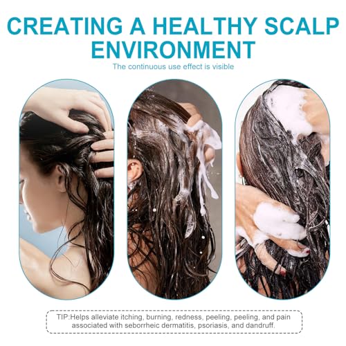 Dry Scalp Shampoo Folliculitis Shampoo, Seborrheic Dermatitis Shampoo, Anti Dandruff Shampoo, Folliculitis Treatment, Dandruff Treatment, with Herbal Essence to Hydrate Hair, Relieve From Itchy - Image 8