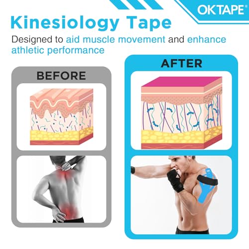 Image of OK TAPE 100Pcs Precut Kinesiology Tape Strips, Elastic Athletic Tape | for Joints Support & Muscle Pain Relief, Waterproof, Kinetic Tape for Shoulder, Knee, Ankle (5 Colors, 2 inch x 10 inch)