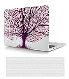 【Compatibilité】UNIQUEMENT compatible avec le modèle A1278 (ancienne version, Macbook pro 13