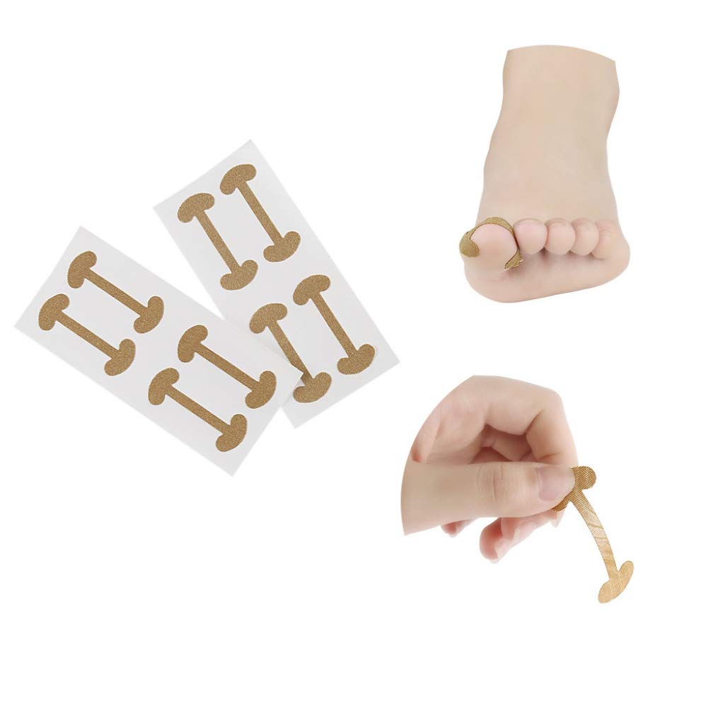 Ingrown Toenail Correction Patches 20Pcs Set Curved Toenails Brace Thick Paronychia Correction Recover Treatment Tool Ingrown Toenail Straightening Clip Pedicure Tool : Beauty & Personal Care