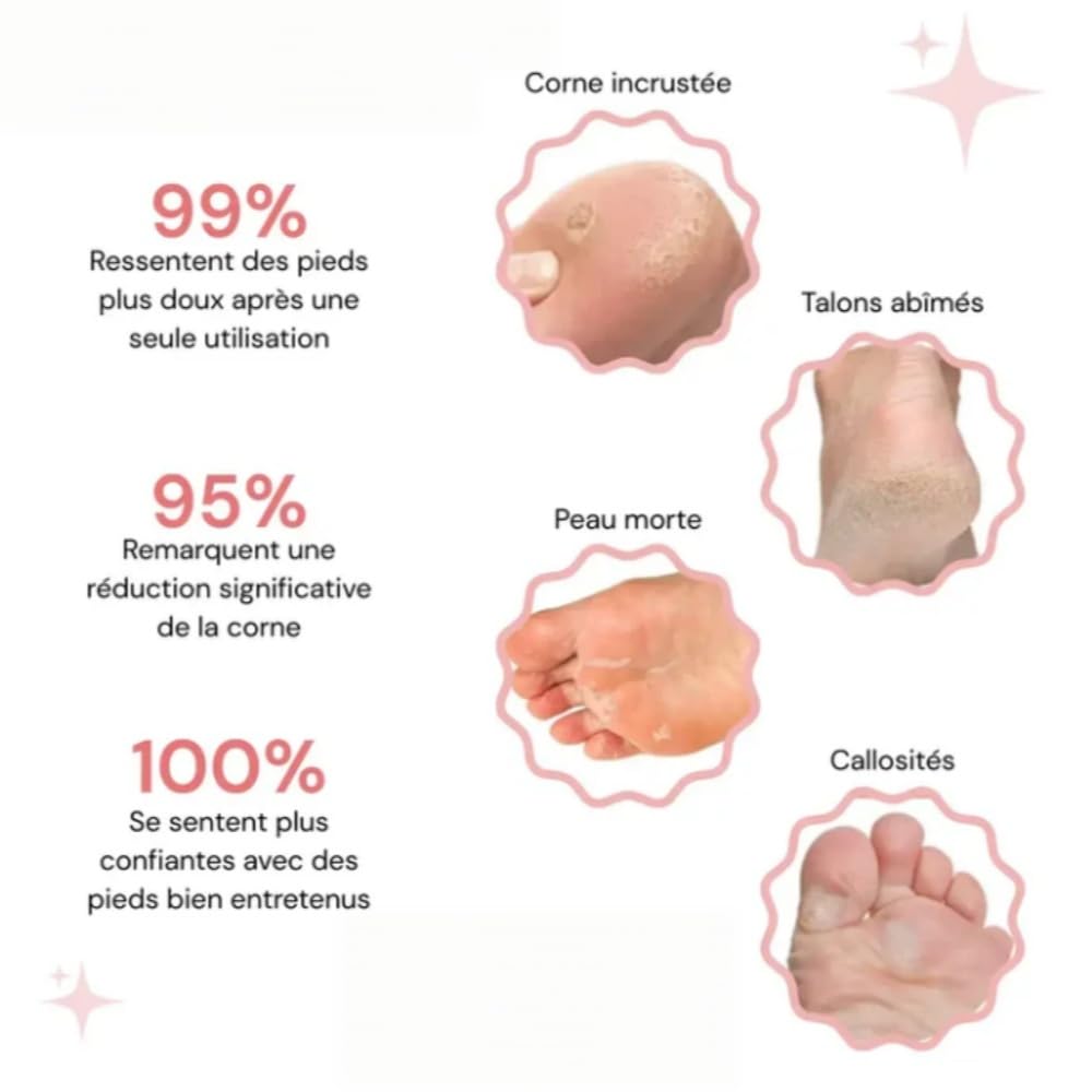 Mielle Glow HoneyGlow Lime électrique pour les pieds, avec 60 disques remplaçables, pédicure maison