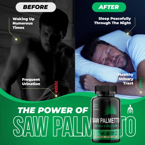 Saw Palmetto Dht Blocker Supplement - Support Prostate Health & Prevent Frequent Urination & Hair Loss + Promote Hair Growth Vitamins For Men & Women - Organic Beta Sitosterol 500Mg #TOP4