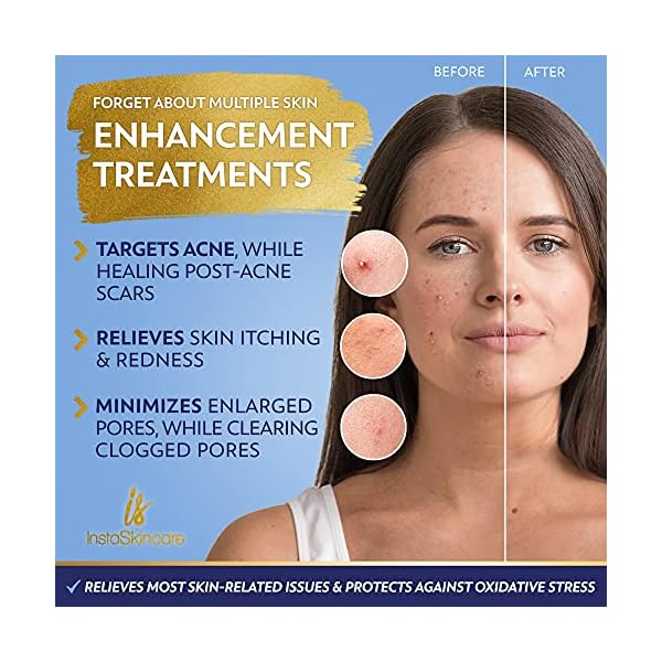 Niacinamide-Serum-for-Face-10-with-Zinc-1-Vitamin-B3-Facial-Serum-for-Acne-Treatment-Dark-Spot-Remover-2-oz-InstaSkincare DOUBLE SIZED (2Oz) Niacinamide Serum for Face 10% with Zinc 1% Vitamin B3 Brightening Serum for for Acne, Dark Spots, Tone, Texture and Hydrating