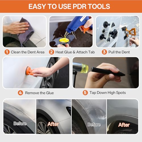 Image of Paintless Dent Repair Kit for Car, PDR Dent Removal Tools with Dent Lifter & Pro Dent Puller Tabs, Auto Body Dent Puller for Car Dent Repair, Hail Damage Repair
