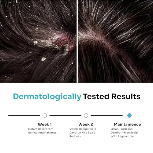 Image of Kitcoz Anti-Dandruff Shampoo, 1% Salicylic Acid & Ceramide Complex, 2x100ml | Clears flakes & buildup while soothing an itchy, irritated scalp