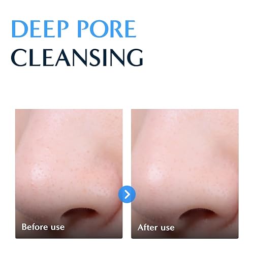 RATAPLAN Donghae deep moisturizing oil to foam cleanser - Double Cleanser, Daily Makeup Blackhead Remover, Oil Cleanser for Face, Korean Facial Cleanser, Korean Skincare 7.10 fl oz