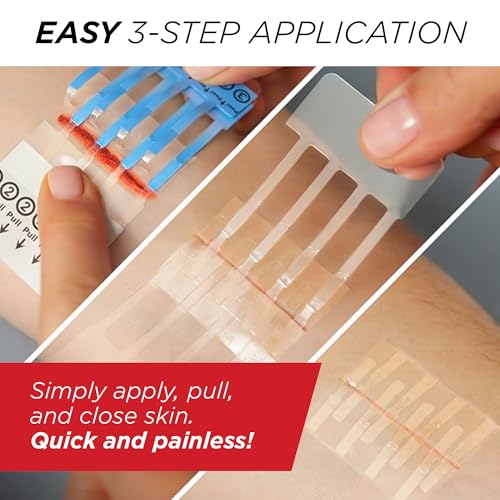 clozex emergency laceration closures - repair wounds without stitches skin closure device for 3 individual wounds or combine for total length of 4 14 inches