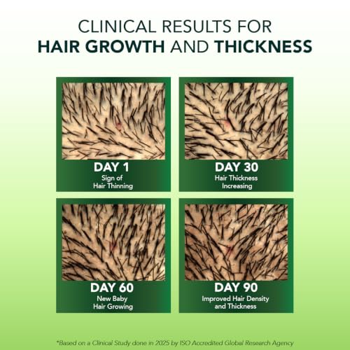 Image of Alps Goodness Rosemary Water Spray for Hair Growth (250ml) | Clinically Proven (In Vivo Tested) to Reduce Hair Fall & Promote Regrowth | 100% Natural Rosemary Extract | Leave-On Scalp & Hair Spray For Men & Women