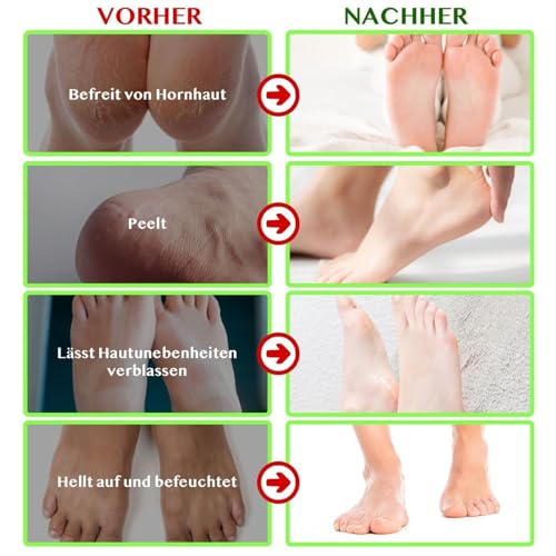 P-Beauty Mascarilla para Pies de Rosa | Exfoliación Intensiva para Pies | Calcetines Anti Callosidades | Renovación e Hidratación de la Piel | Elimina Callos y Grietas | 1 Par - imagen 9