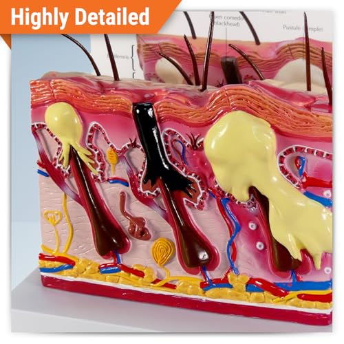Image of GPI Anatomicals Cross-Section Skin Acne Model, Normal & Acne-Riddled Skin