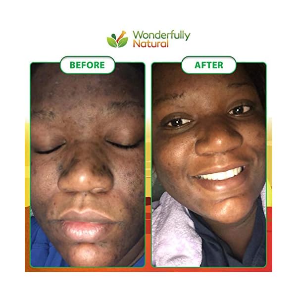 Organic African Black Soap - For Acne & Dark Spots | Natural Vegan and Cruelty Free â Satisfaction Guarantee 1lb bar | 90 day Supply