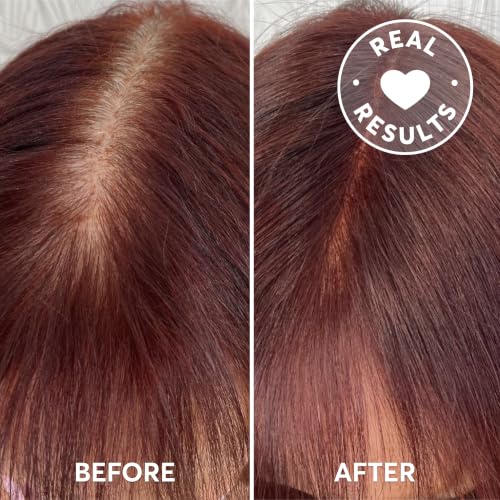 Image of Madison Reed Root Perfection Root Touch Up Kit for T-Zone - 6R Pesaro Red, 2 Permanent Applications, Gray-Blending Color in 10 Min | PPD-Free & Ammonia-Free, Includes Hydrating Hair Mask