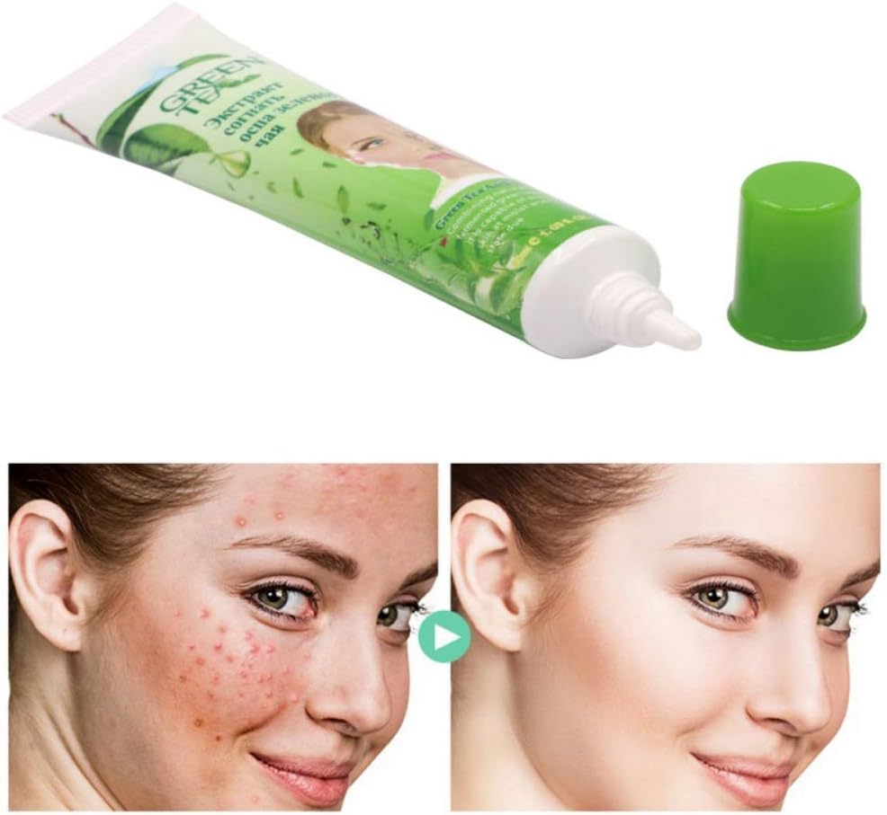 крем от прыщей. следоцид пчелиный чистотел. Dr. д/умывания от прыщей д/чувствит. крем для проблемной кожи от прыщей.