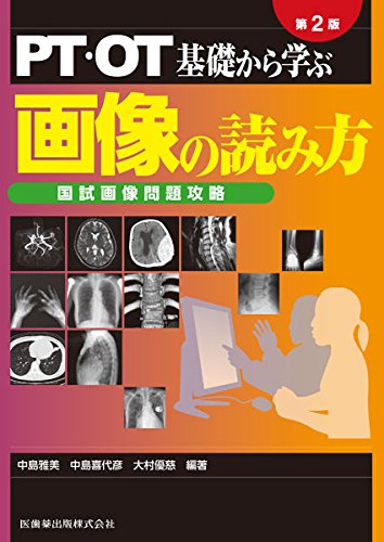 PT・OT 基礎から学ぶ 画像の読み方 第2版 国試画像問題攻略
