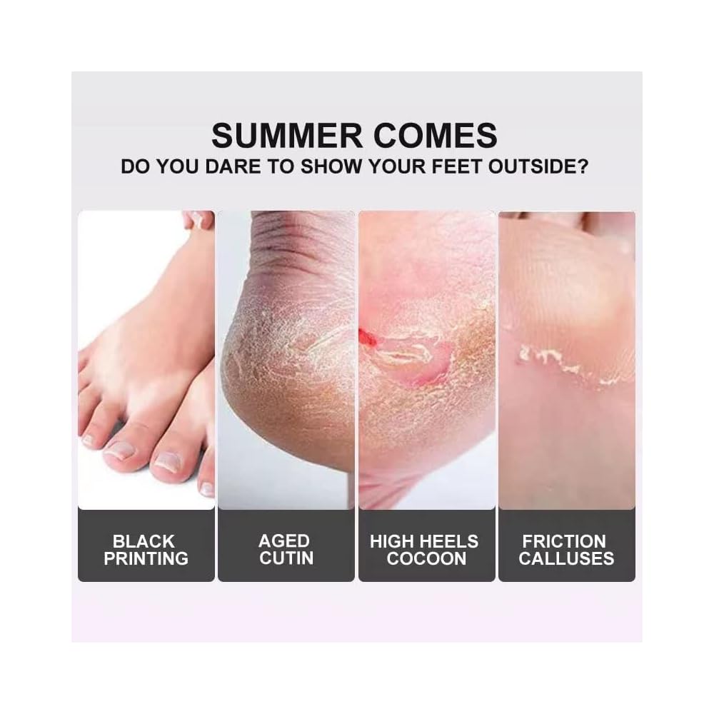 Lavender Foot Peel Mask Pack for Soft, Smooth Feet Morocco Ubuy