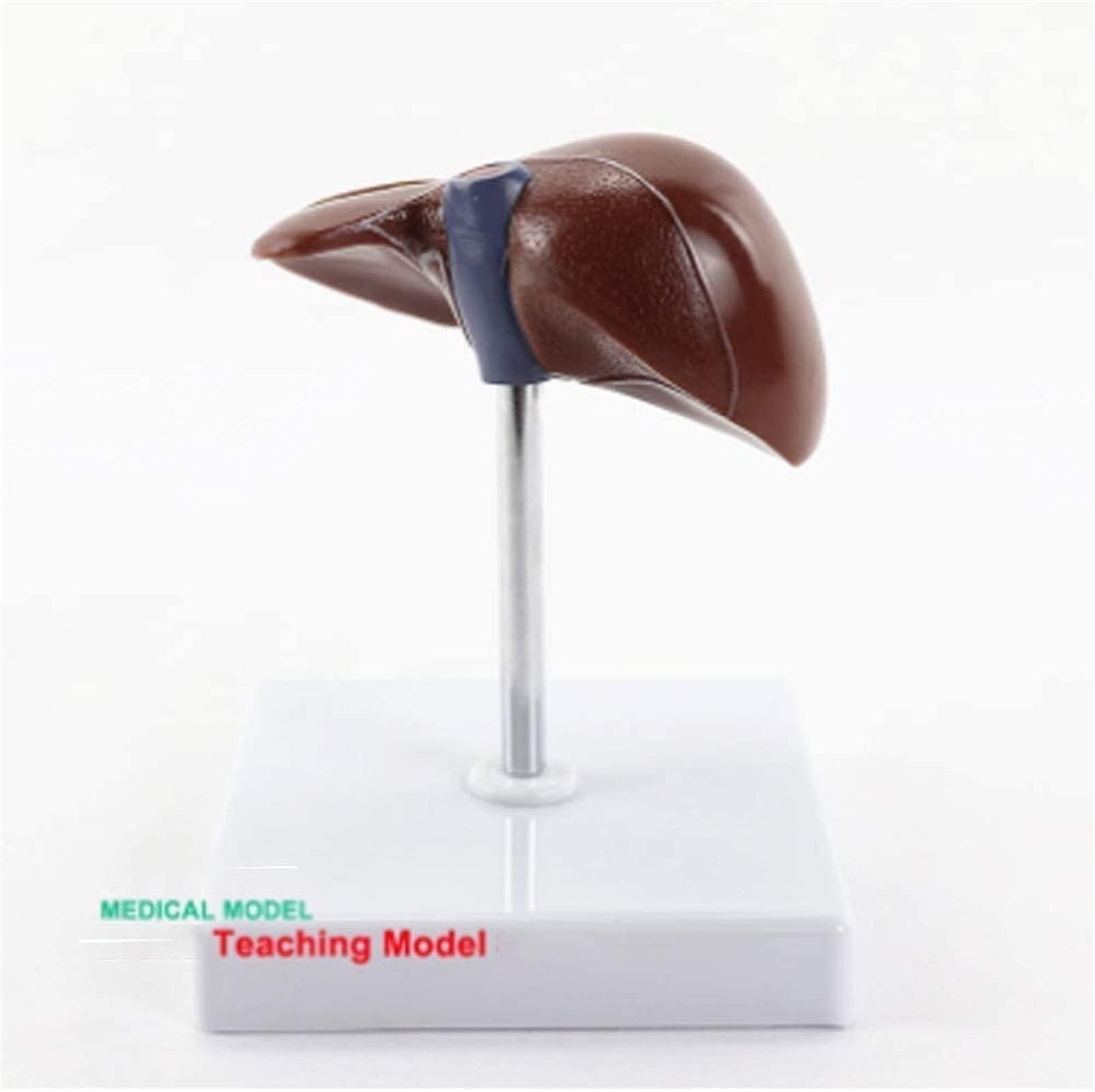 Human liver pathological stones anatomical model, medical model, educational model anatomical model, suitable for medical school education learning teaching aids demonstration laboratory scientific eq