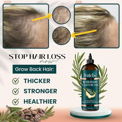 Unlock Luxurious Locks: The Ultimate Review of Rosemary Castor Oil for Hair Growth