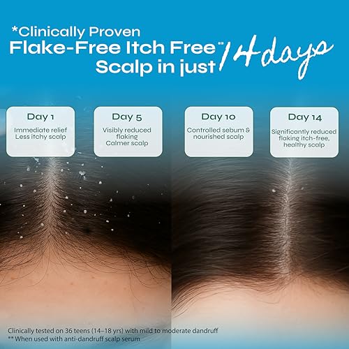 Image of Tikitoro Teens Anti-dandruff Shampoo and Scalp Serum Combo | Cleanses Scalp and Fights Dandruff Causing Fungi | All Scalp Types | No Parabens & Sulphates (Age: 11+) (300ml x 1 and 100ml x 1)