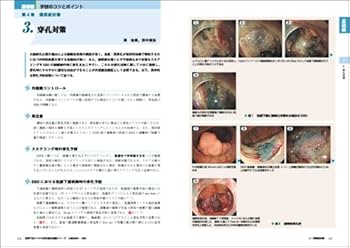 3冊セット 胃炎の京都分類 大腸ＥＭＲ・ＥＳＤ　Ｃａｓｅ　Ｓｔｕｄｙで病変に最適 症例で身につける消化器内視鏡シリーズ：大腸EMR・ESD 改訂版